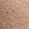 dull, rough skin